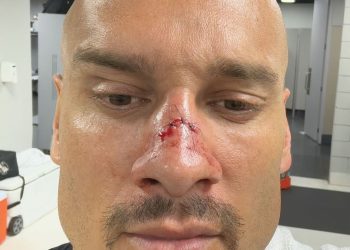 Jogador do Vasco sai de campo totalmente "detonado" após classificação