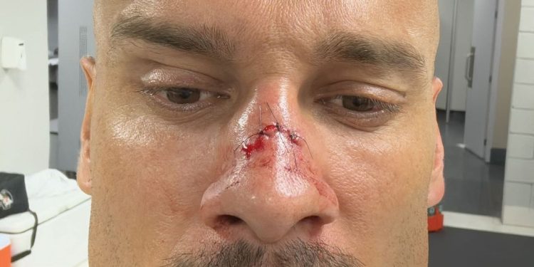 Jogador do Vasco sai de campo totalmente "detonado" após classificação